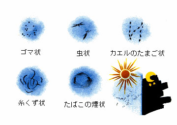 飛蚊症と光視症