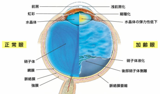 飛蚊症と光視症