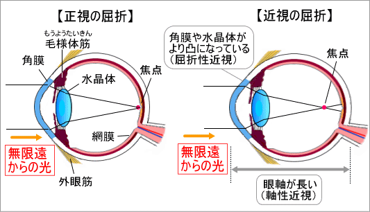 のか する 視力 回復 は 視力って回復するの？