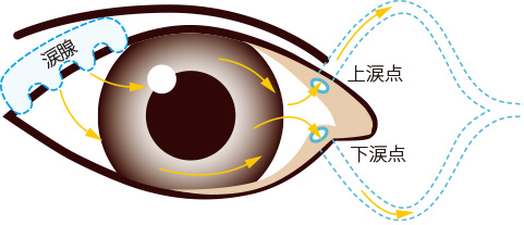 涙点プラグ（涙点閉鎖）