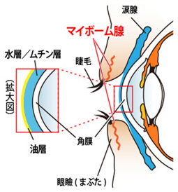 MGD（マイボーム腺機能不全）治療