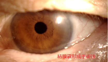 が し 目 痛い ゴロゴロ て 目が充血して痛い！片目だけ･チクチク･ゴロゴロの原因。コンタクトの影響やアレルギーかも。目薬は？