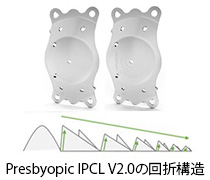 多焦点IPCL