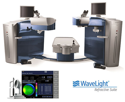 Alcon wavelight ex500 healthcare changes over the years