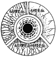 結膜炎 フリクテン 性